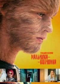 Реальная история мальчика-волчонка