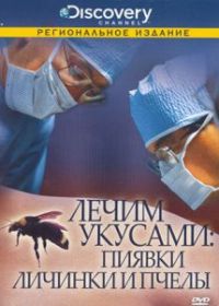 Discovery: Лечим укусами. Пиявки, личинки и пчелы